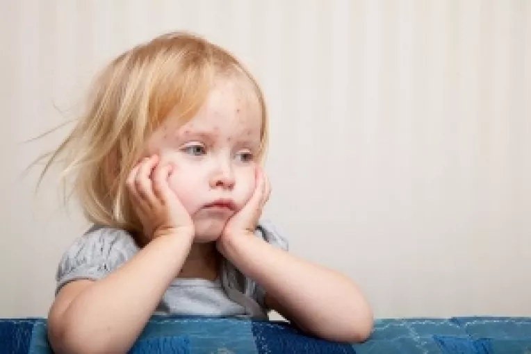 Campania impotriva vaccinarii face victime: 3 copii decedati si 675 de cazuri de rujeola