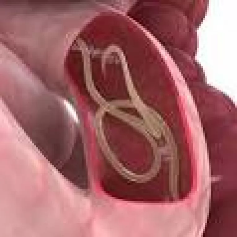 Infectarea cu paraziti se poate face in urma consumului de apa, fructe sau legume contaminate cu oua de paraziti