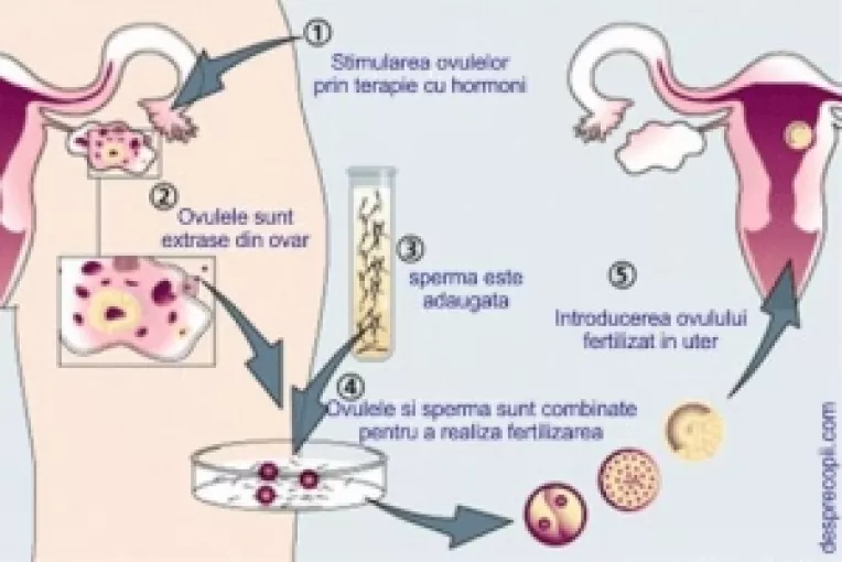 Prof. Carlos Simon a inventat testul care determina momentul propice pentru fertilizare in vitro